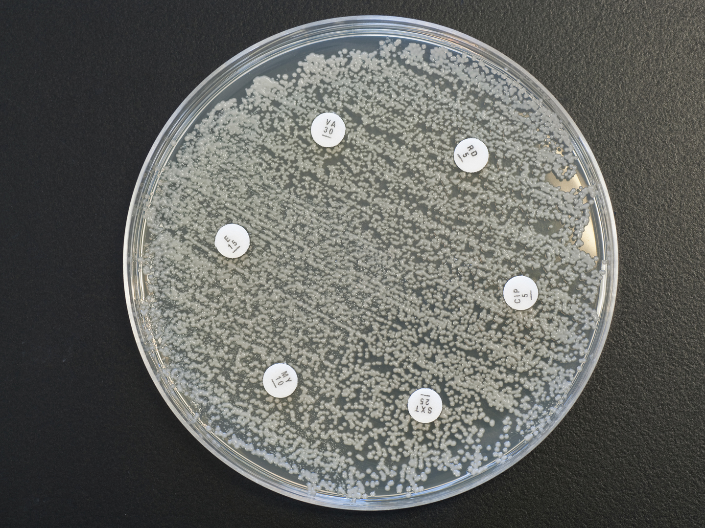 Clindamycin:可怕的抗生素Andrew WeilMD